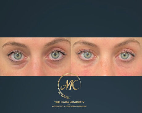 Dermal Fillers case #2592