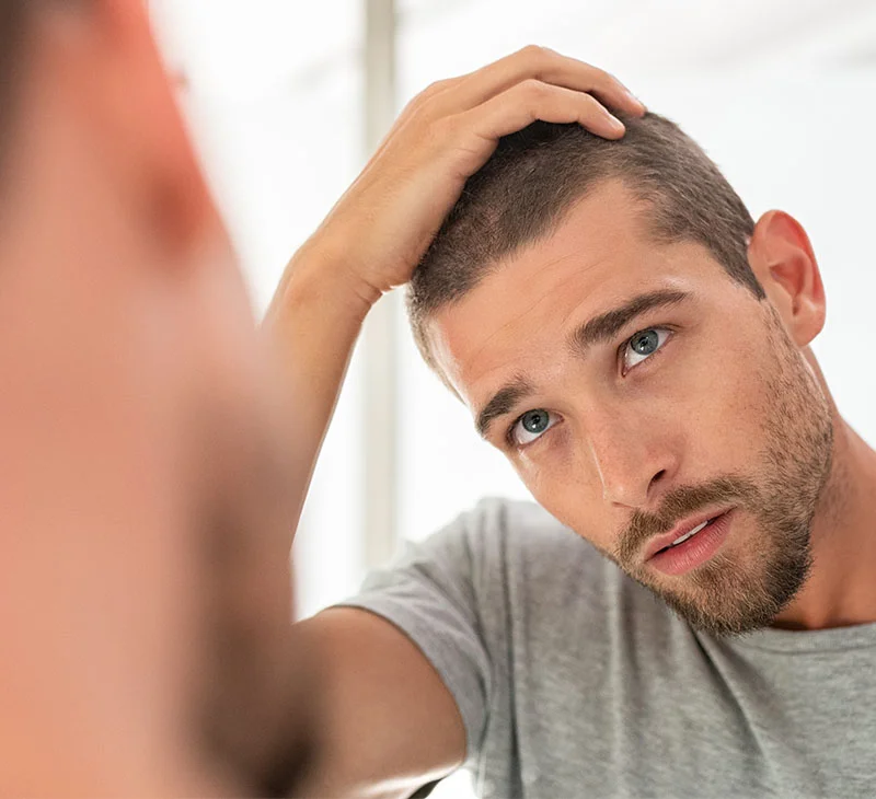 Man with short hair and beard, looking at himself in the mirror while touching his head - Alma TED Treatment in Red Bank, NJ