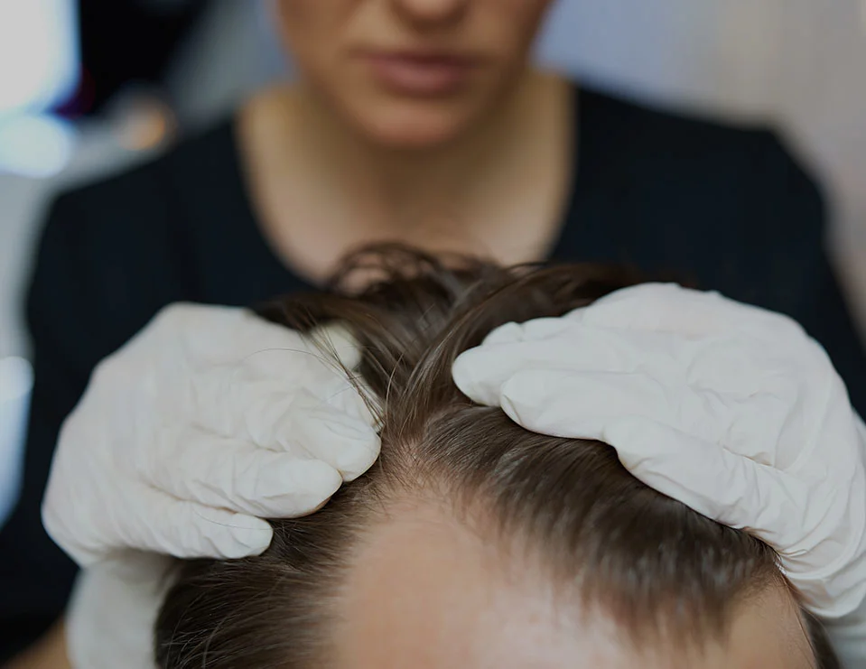 Hair Restoration at the Kaga Academy in Red Bank, NJ